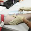 Анализы на мужские гормоны - какие сдавать, список, расшифровка